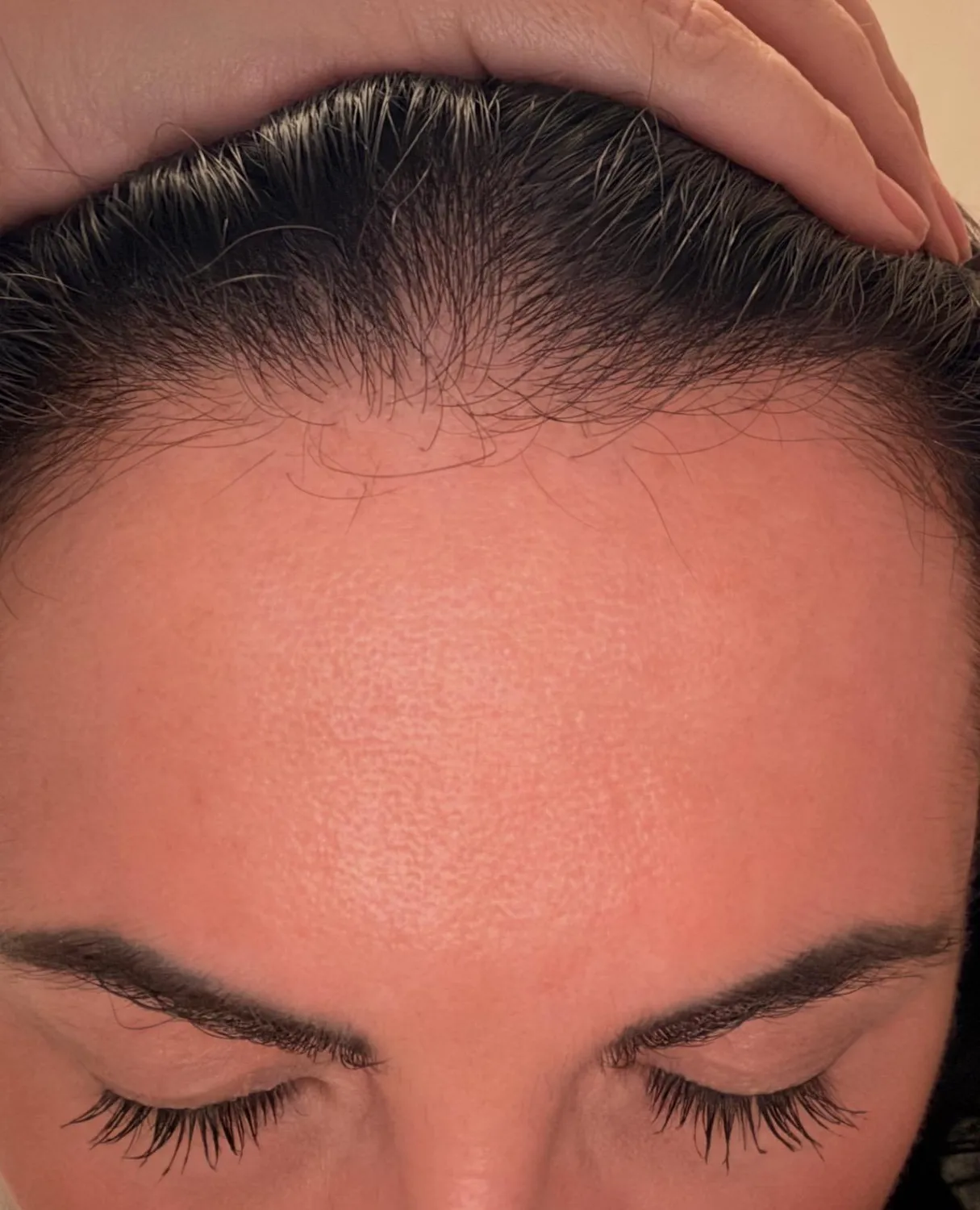 Chāmpo Pitta Growth Serum Trio haargroei serum 3-pack dun haar