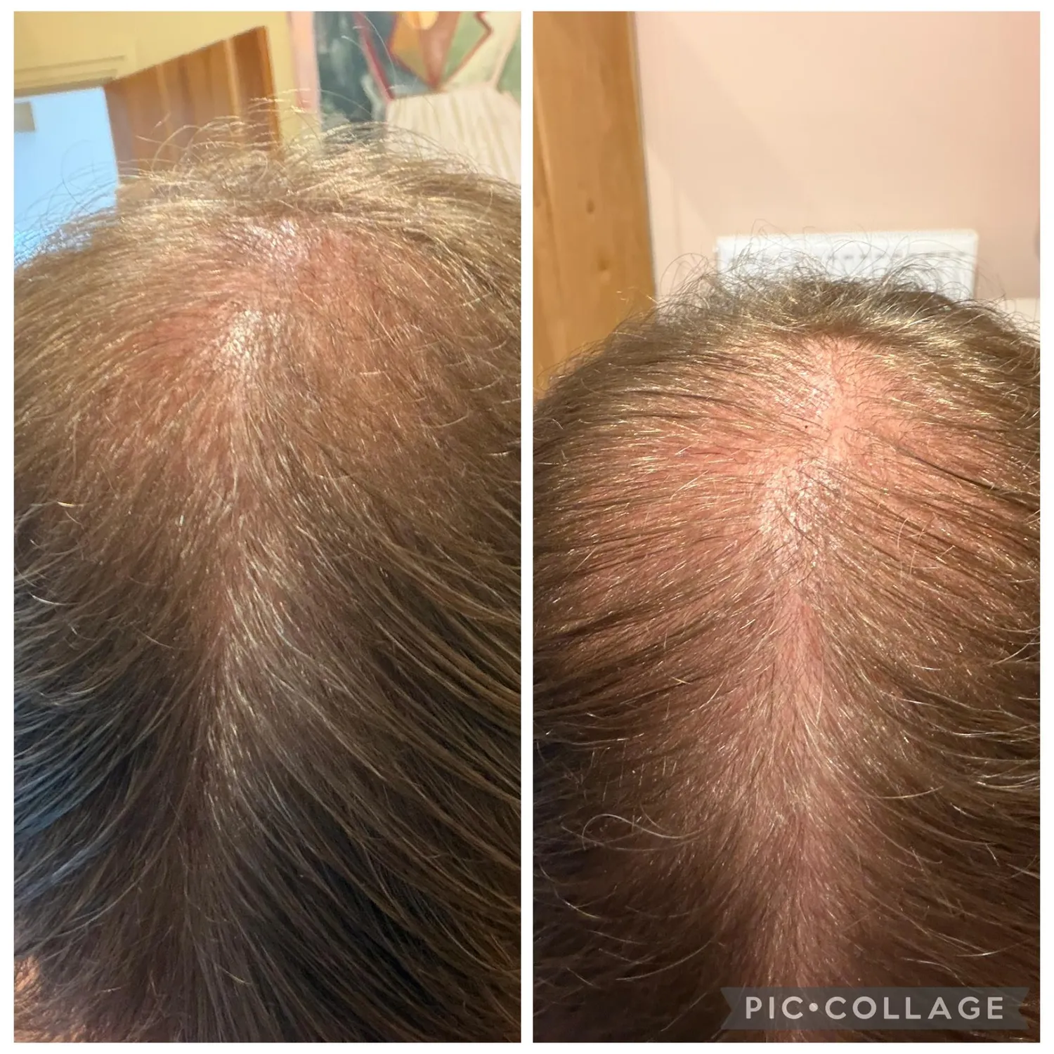 Chāmpo Pitta Ultimate Volumising System haarset 4-staps fijn haar