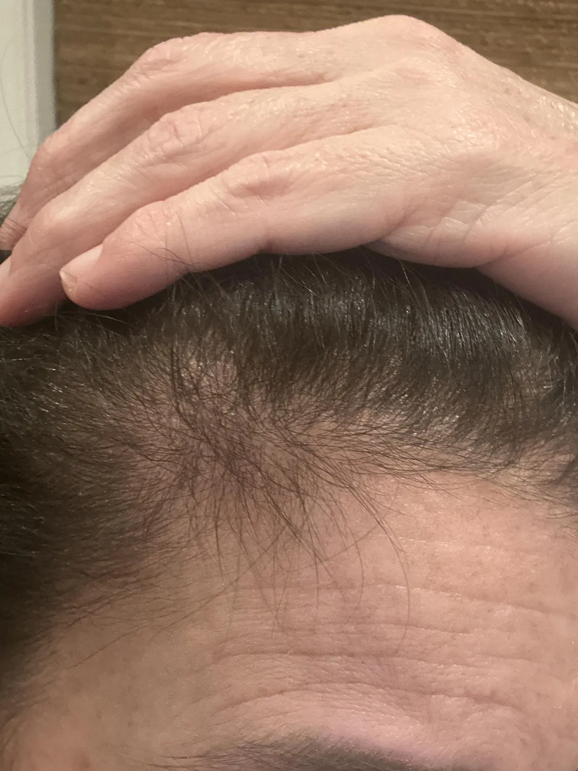 Chāmpo Pitta Ultimate Volumising System haarset 4-staps fijn haar