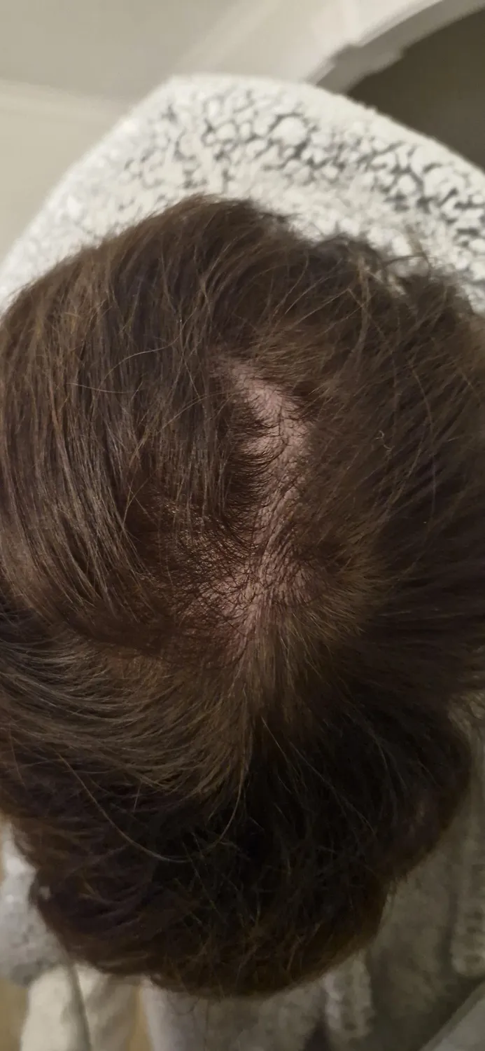 Chāmpo Pitta Ultimate Volumising System haarset 4-staps fijn haar