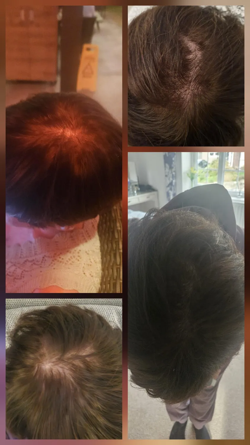 Chāmpo Pitta Ultimate Volumising System haarset 4-staps fijn haar