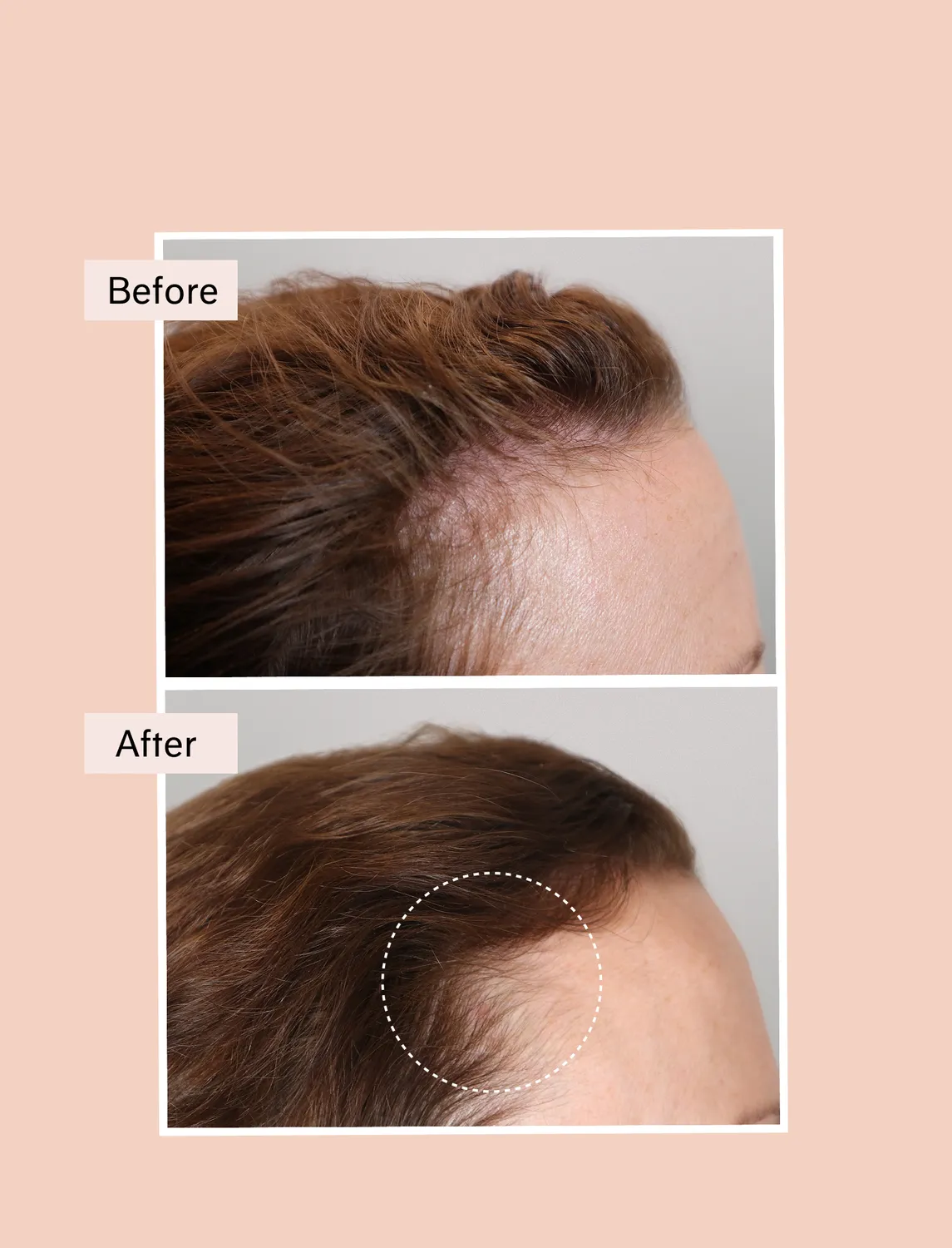 Chāmpo Pitta Growth Serum haargroei serum 30ml dun haar