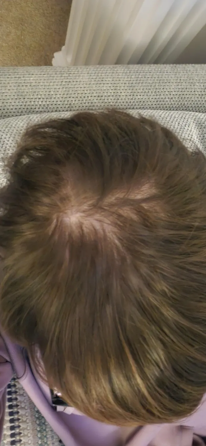 Chāmpo Pitta Ultimate Volumising System haarset 4-staps fijn haar