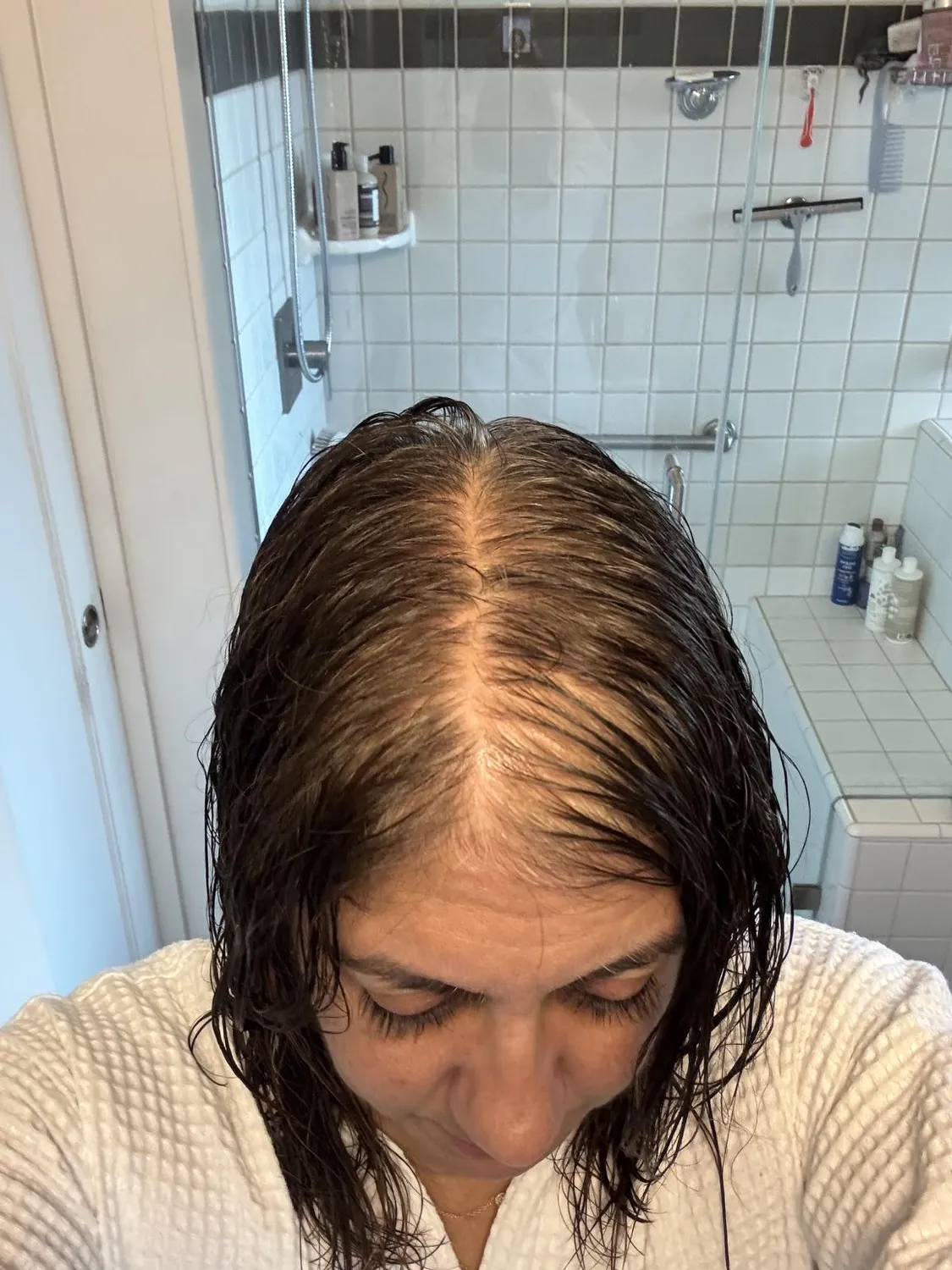 Chāmpo Pitta Growth Serum Trio haargroei serum 3-pack dun haar